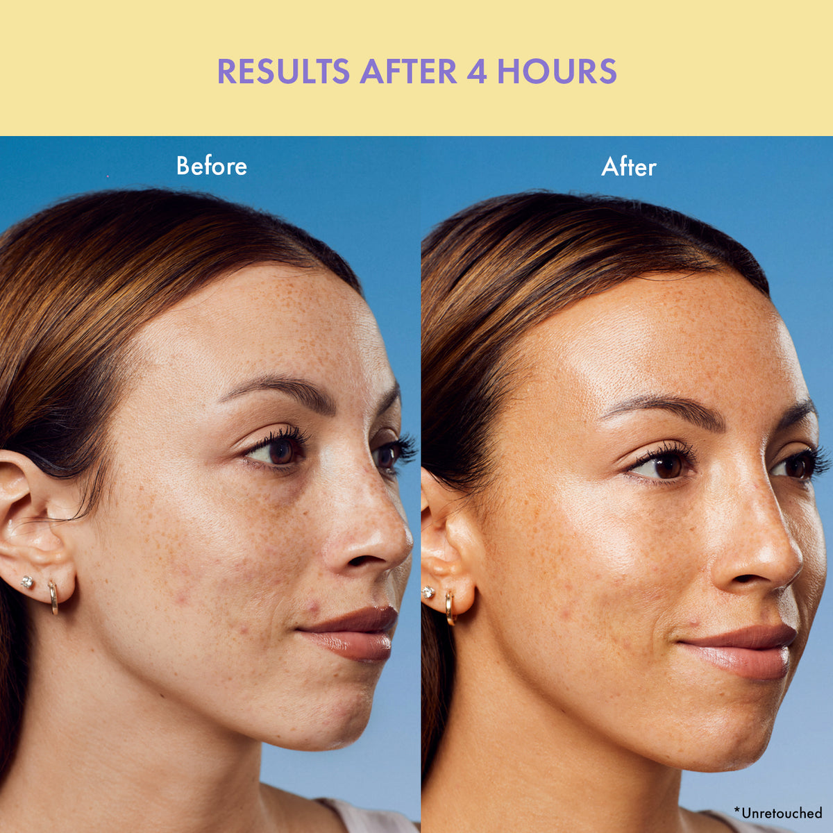 Before and after comparison of skin tone using IOP Self-Tanning Drops