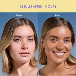 Bronzed Bestsellers Set